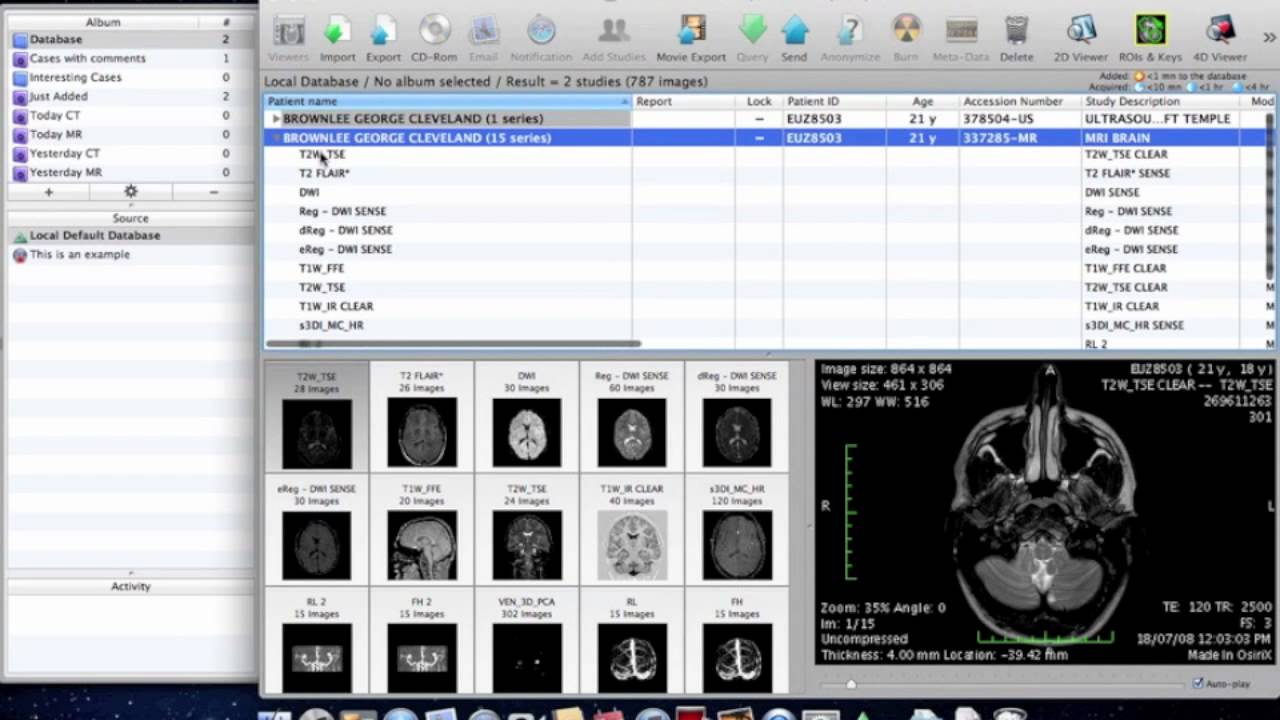 Codonics Clarity Viewer For Mac Download